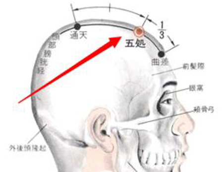 五處穴→清熱散風(fēng)