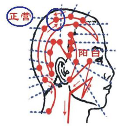 正營穴→治頭痛、頭暈