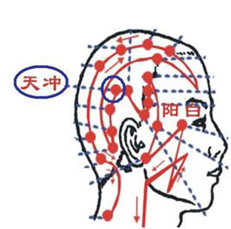 天沖穴→治頭痛、齒痛