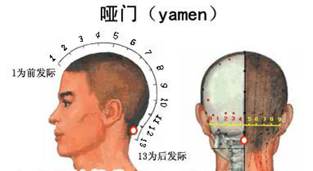 啞門穴→治音啞、頭痛