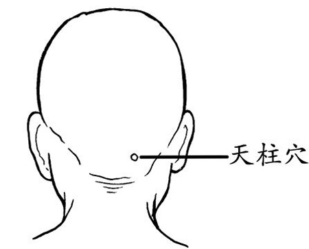 天柱穴→治頭痛、項(xiàng)強(qiáng)