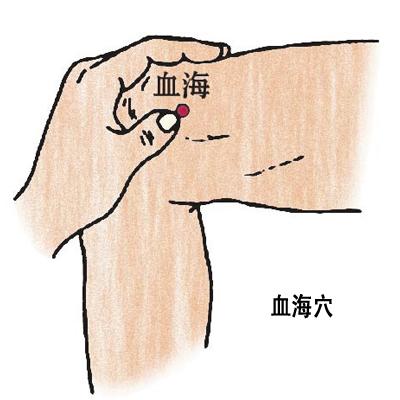 血海穴→治濕疹、丹毒