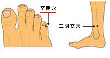 至陰穴→治頭痛、目痛