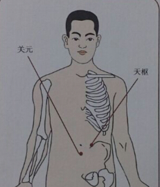 針灸治療便秘哪個穴位？便秘的針灸療法