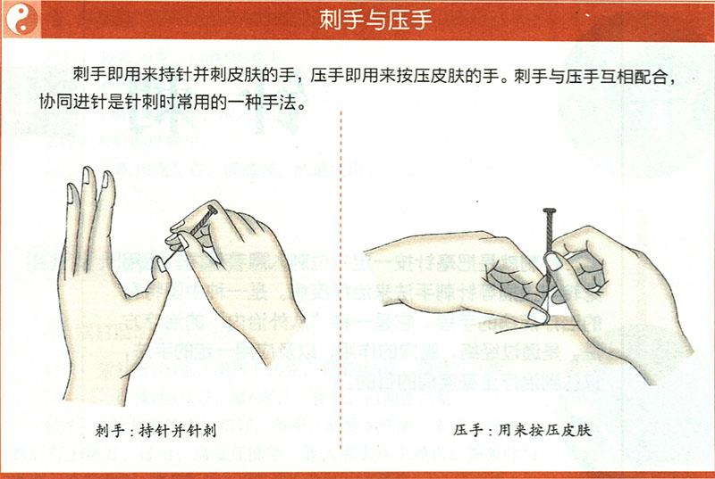 一般針?lè)ǖ倪\(yùn)用原則是什么？