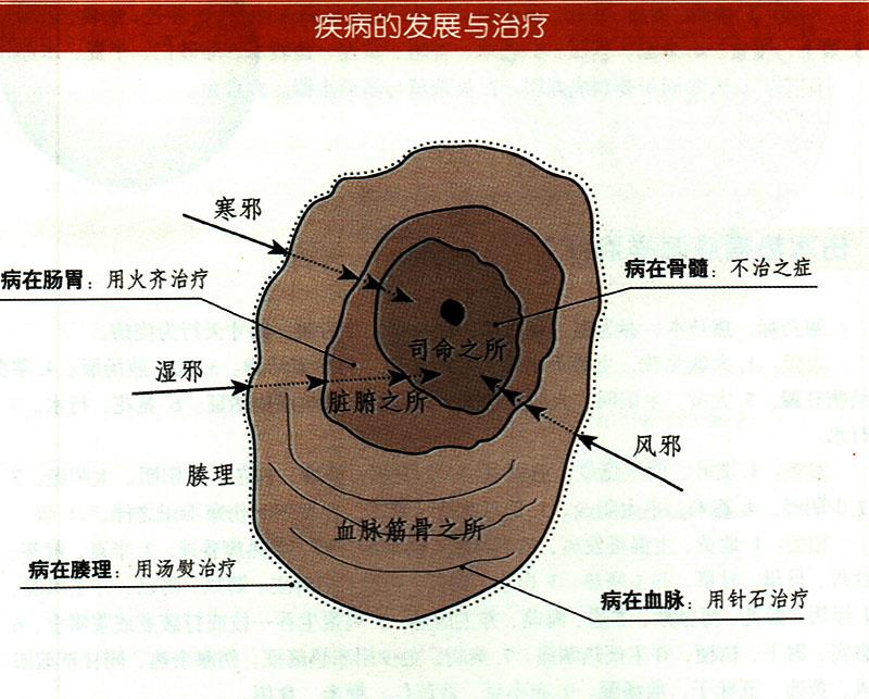 諸氣應(yīng)怎樣治療？