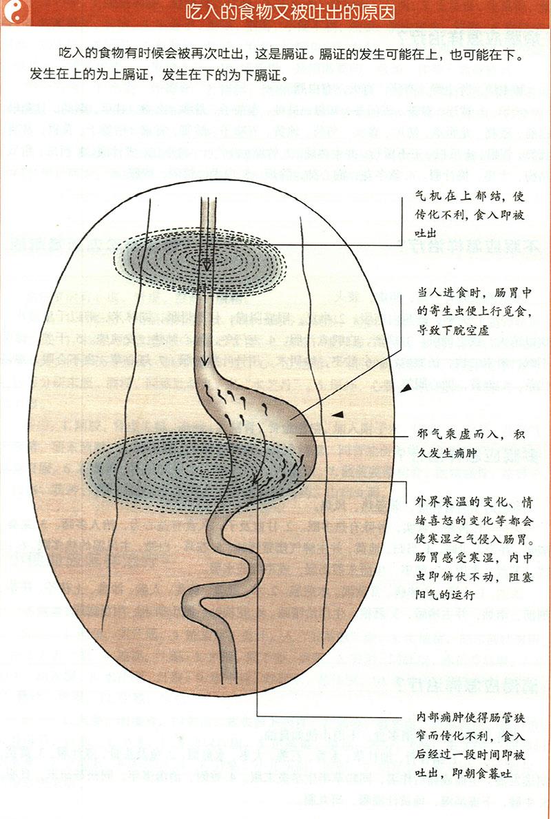 嘔吐應(yīng)怎樣治療？