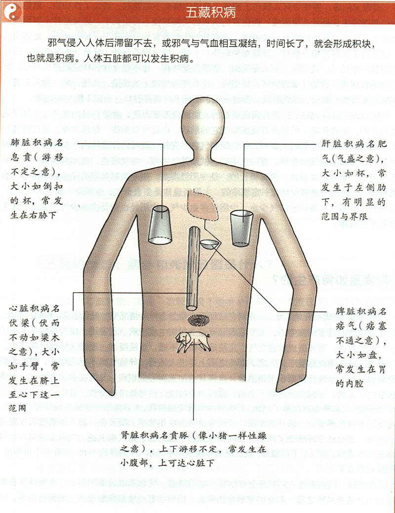 積病是如何產(chǎn)生的？