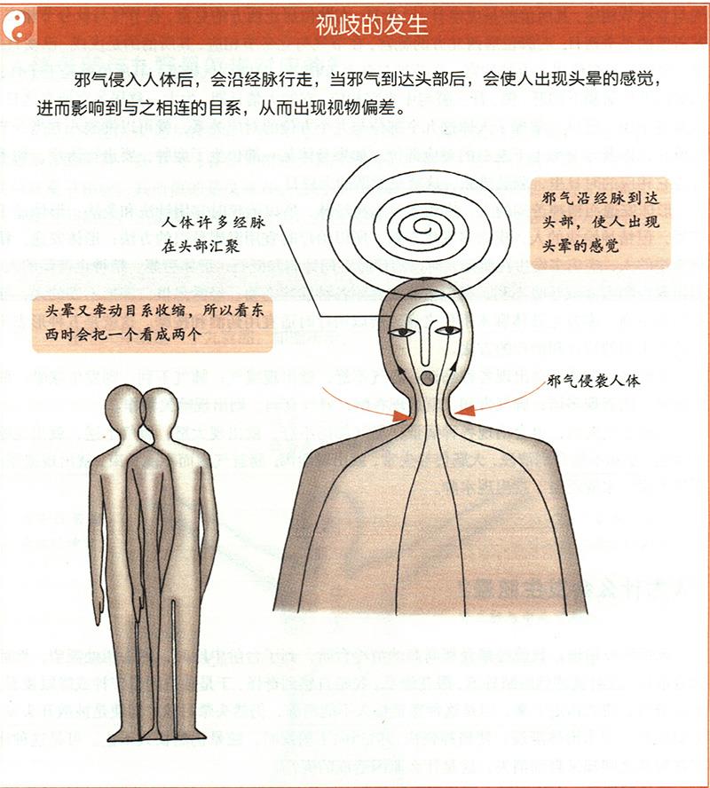人為什么會(huì)發(fā)生眩暈？