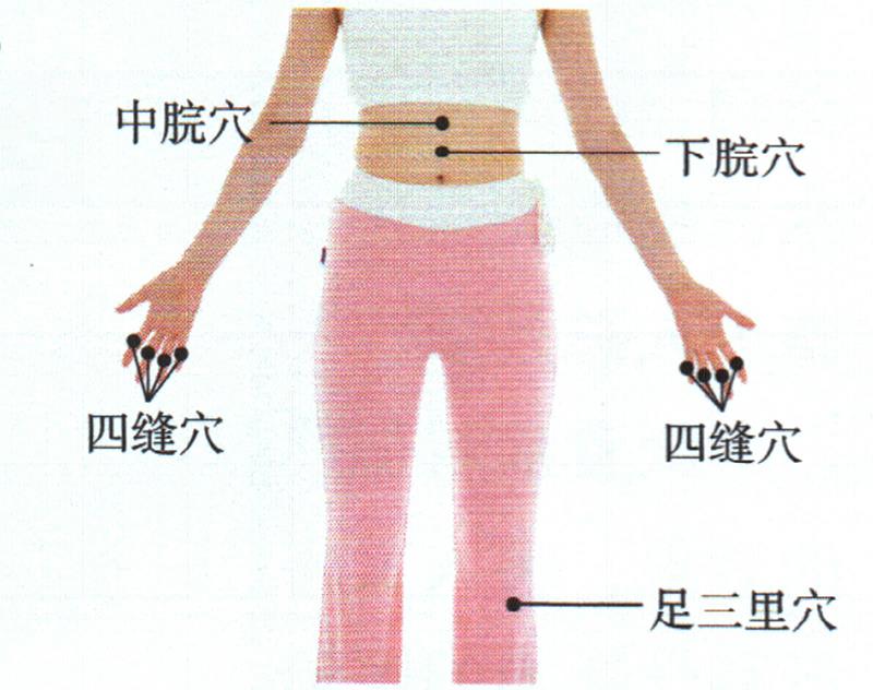按摩足三里穴、四縫穴、中脘穴，促進(jìn)吸收增點(diǎn)肉